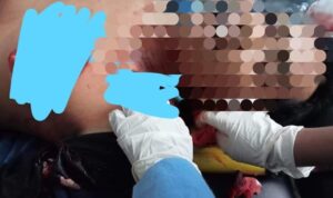 Korban Sa'at ditangani Tim Medis