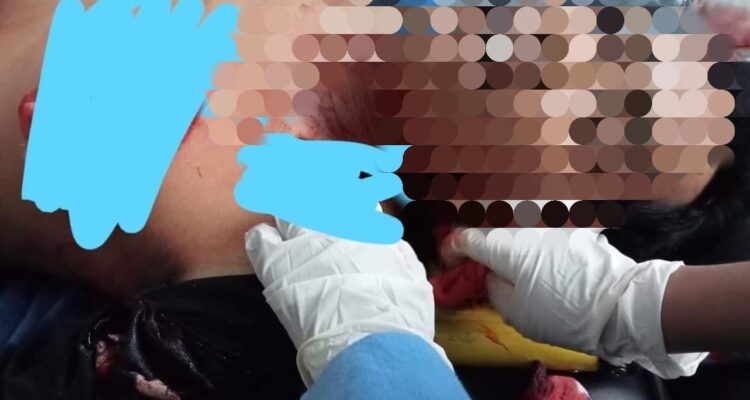 Korban Sa'at ditangani Tim Medis